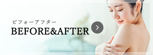 BEFORE&AFTER
